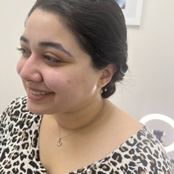 Et Aesthetics - After treatment photo - Medical Spas Near Me - Peachtree Corners, Georgia