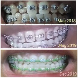 Progress