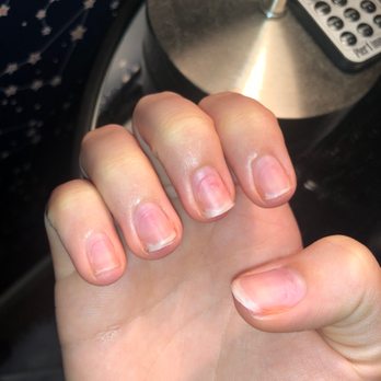 Mini Nails - My destroyed nails - Nail Salons Near Me - Eugene, Oregon