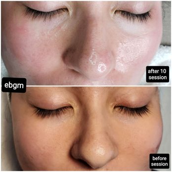 Esthetique by Grace M - Estheticians Near Me - Northridge, California