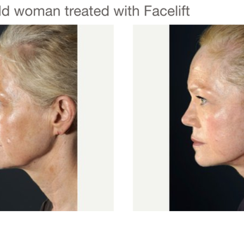 Lara Devgan, MD - Plastic & Reconstructive Surgery - Face Lift - Cosmetic Surgeons Near Me - New York, New York Lara Devgan, MD - Plastic & Reconstructive Surgery - Face Lift - Cosmetic Surgeons Near Me - New York, New York