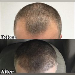 Aurora Medi Spa