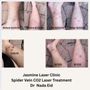 Photo of Jasmine Laser Hair Removal