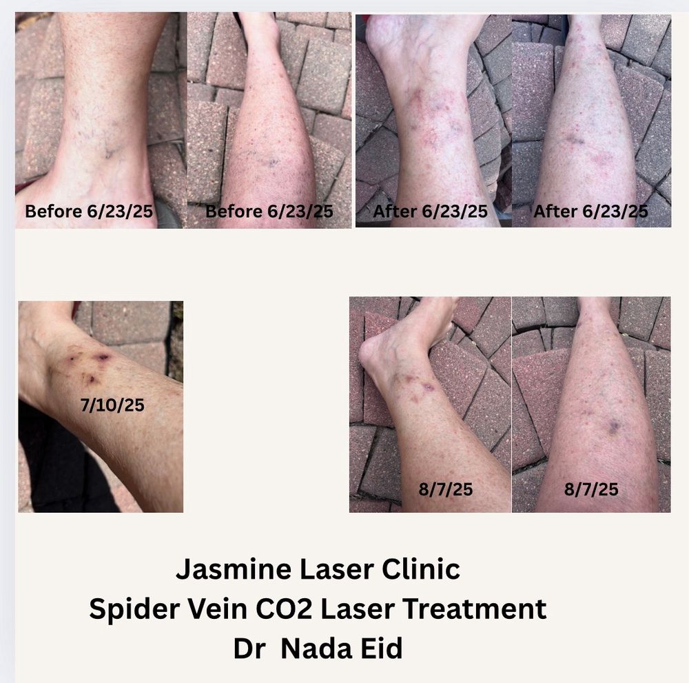 Jasmine Laser Hair Removal Logo