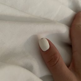 One day after getting gel