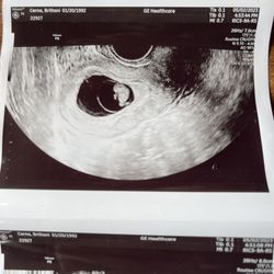 Laurel Fertility Care - Our little boy! All thanks to Laurel fertility!