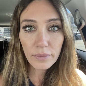 Eos Rejuvenation - After - Cosmetic Surgeons Near Me - Beverly Hills, California