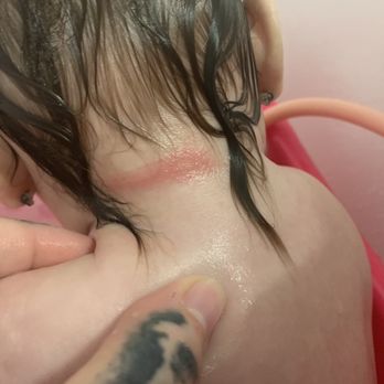 Chappell Schools - The red mark from her bib getting snatched from her neck - Elementary Schools Near Me - Jacksonville, Florida Chappell Schools - The red mark from her bib getting snatched from her neck - Elementary Schools Near Me - Jacksonville, Florida