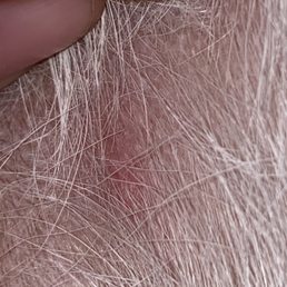 Another scab near her leg
