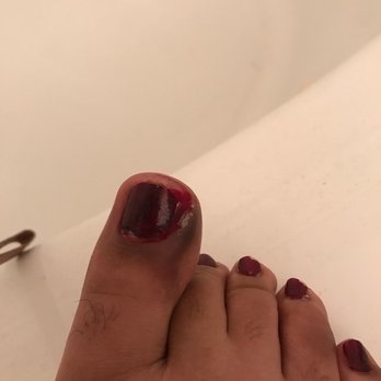 Post Oak Nail Lounge - My toe nail after it got infected from going to this nail shop. NEVER AGAIN!!!! - Nail Salons Near Me - Houston, Texas Post Oak Nail Lounge - My toe nail after it got infected from going to this nail shop. NEVER AGAIN!!!! - Nail Salons Near Me - Houston, Texas