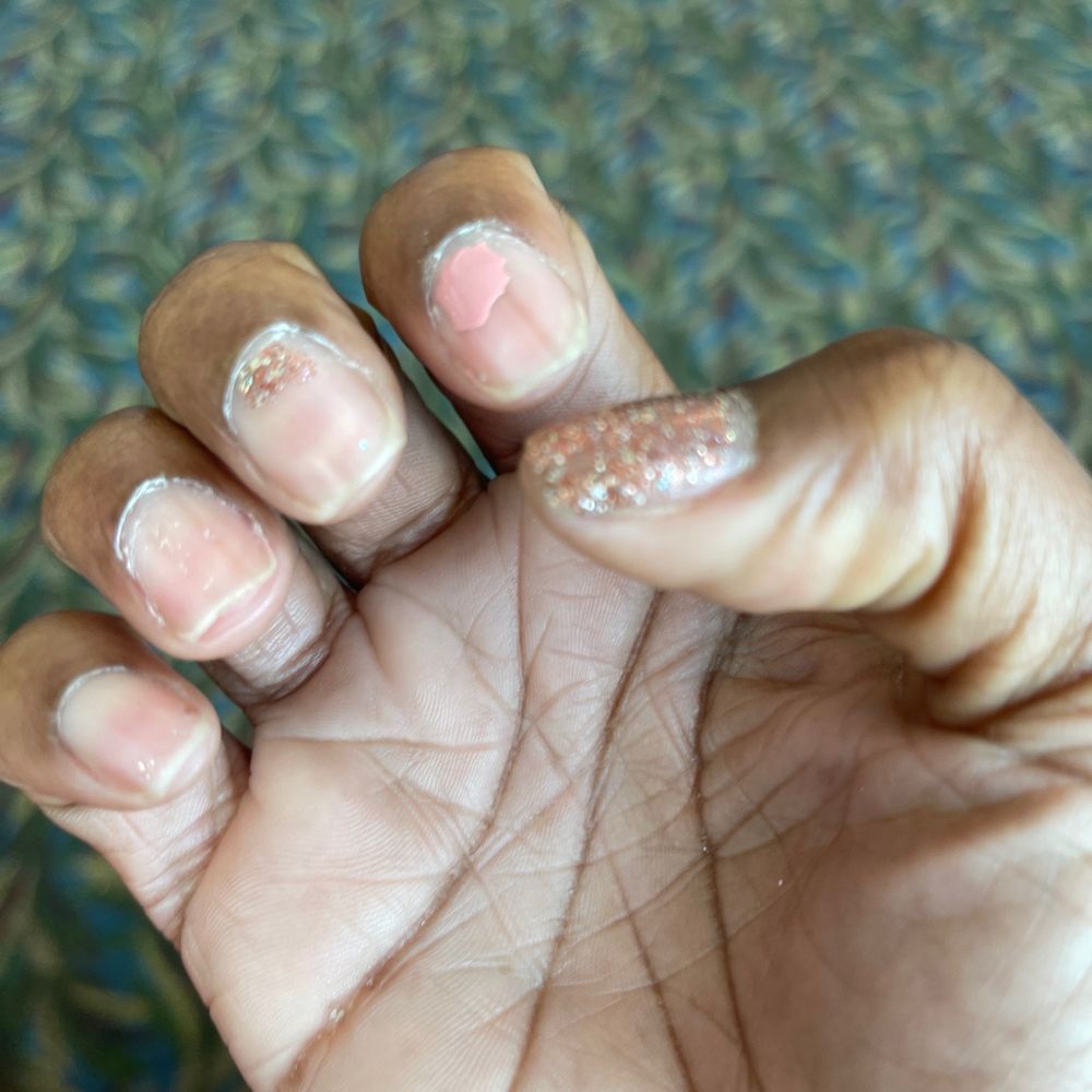 Fingernails
