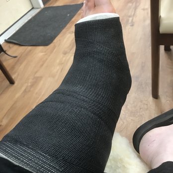 Select Foot and Ankle Specialists - First cast - Podiatrists Near Me - Cypress, Texas Select Foot and Ankle Specialists - First cast - Podiatrists Near Me - Cypress, Texas