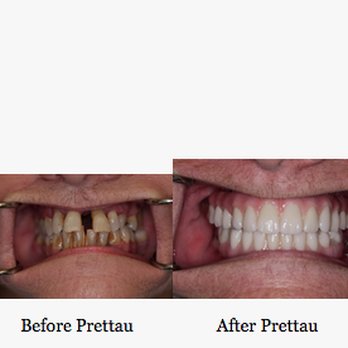 Rick Brar, DMD - Brar Dentistry - Cosmetic Dentists Near Me - St. Charles, Illinois Rick Brar, DMD - Brar Dentistry - Cosmetic Dentists Near Me - St. Charles, Illinois