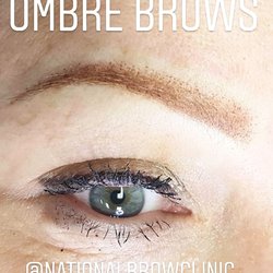 National Brow Clinic