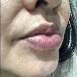 SoCal Surgical Arts - After