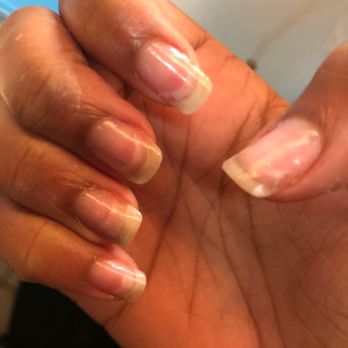 Venetian Nail Spa - The lines on them are from over filing. I went to another nail shop they didn't want to touch them because "they need to heal" - Nail Salons Near Me - Baton Rouge, Louisiana Venetian Nail Spa - The lines on them are from over filing. I went to another nail shop they didn't want to touch them because "they need to heal" - Nail Salons Near Me - Baton Rouge, Louisiana