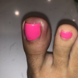 Honey B Nail Spa - Infected toe