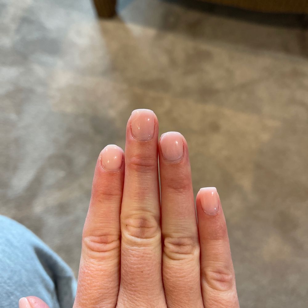 Chipped nails. Chipped nails.