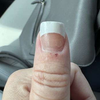VIP Nails - Bumpy nail and burn from sharp buffer - Nail Salons Near Me - Palm City, Florida
