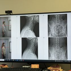 The Drugless Doctors - Posture and neck