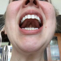 Carly Schneider Orofacial Myology - One exercise: the tongue cave