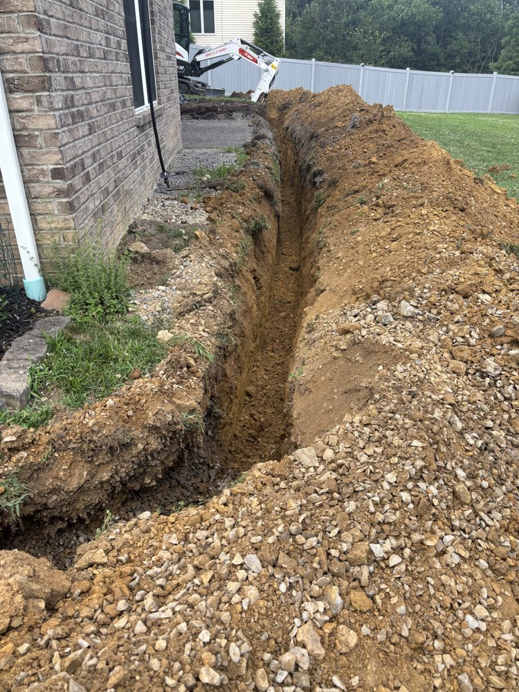 Slide of Pfeuffer Contracting