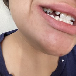 Jeannie A. Molato,DMD -Laser Dental Bakersfield - Old teeth
