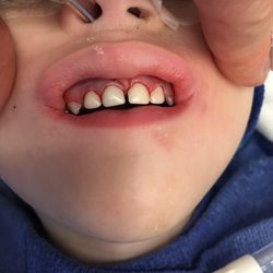 Young Smiles Children's Dentistry