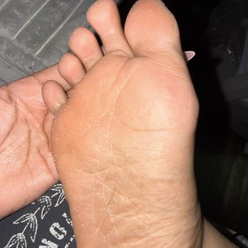 That Colour Nails - Dry and flaking all over my foot - Nail Salons Near Me - Chicago, Illinois