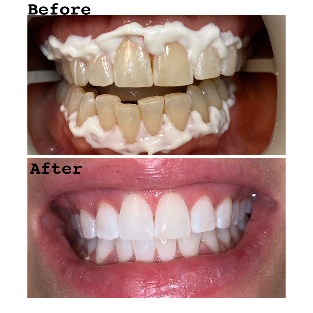 YORKTOWN DENTAL SPA 12 Photos & 13 Reviews General Dentistry 5373