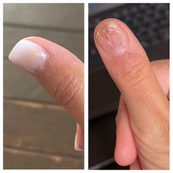 Spa & Nails by Amy - Ombre acrylic nail to provide a protective cover over my scar tissue covered thumb. Amazing!!