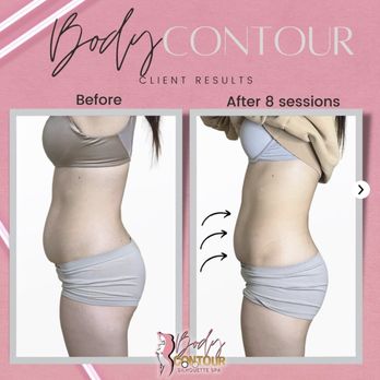 The Body Contour Spa - Body Contouring Near Me - Vancouver, British Columbia The Body Contour Spa - Body Contouring Near Me - Vancouver, British Columbia