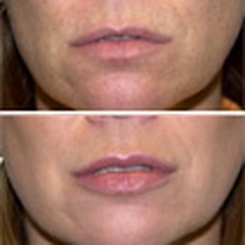 Michael Godin, MD - Cosmetic Surgeons Near Me - Richmond, Virginia Michael Godin, MD - Cosmetic Surgeons Near Me - Richmond, Virginia