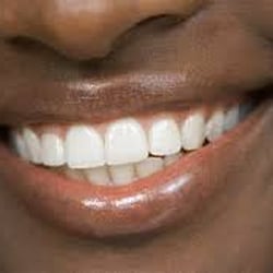 Angel Dental Care - Confident Smile!