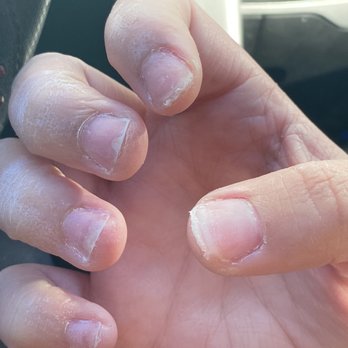 Sexy Nail Spa - Acrylic on both nails. (Thumb and pointer finger) As you can also see my nails aren't short at all. - Nail Salons Near Me - Fair Lawn, New Jersey Sexy Nail Spa - Acrylic on both nails. (Thumb and pointer finger) As you can also see my nails aren't short at all. - Nail Salons Near Me - Fair Lawn, New Jersey