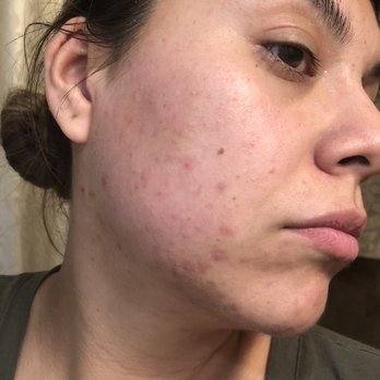 Gerard Nat, MD - This was through the process - Dermatologists Near Me - Downey, California Gerard Nat, MD - This was through the process - Dermatologists Near Me - Downey, California