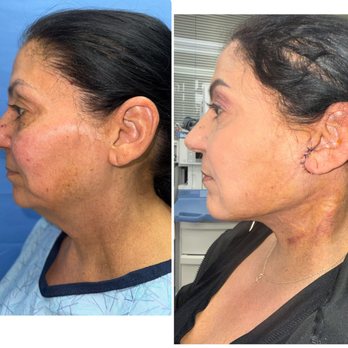 Thomas W. Barnes, MD - Cosmetic Surgeons Near Me - Newport Beach, California Thomas W. Barnes, MD - Cosmetic Surgeons Near Me - Newport Beach, California