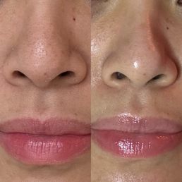 After extraction After extraction