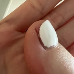 My poor toe :( guess she decided my nail didn't need a corner anymore. My poor toe :( guess she decided my nail didn't need a corner anymore.