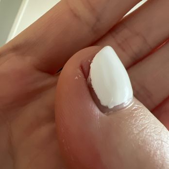 Joy Nails II - My poor toe :( guess she decided my nail didn't need a corner anymore. - Waxing Near Me - Galveston, Texas Joy Nails II - My poor toe :( guess she decided my nail didn't need a corner anymore. - Waxing Near Me - Galveston, Texas