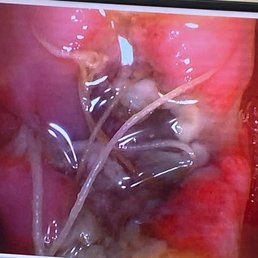 Photo of Raina's brilliant extraction work :)