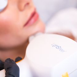 Kalologie Medspa Thousand Oaks - Quickly and effectively reduces hair, regardless of skin color.