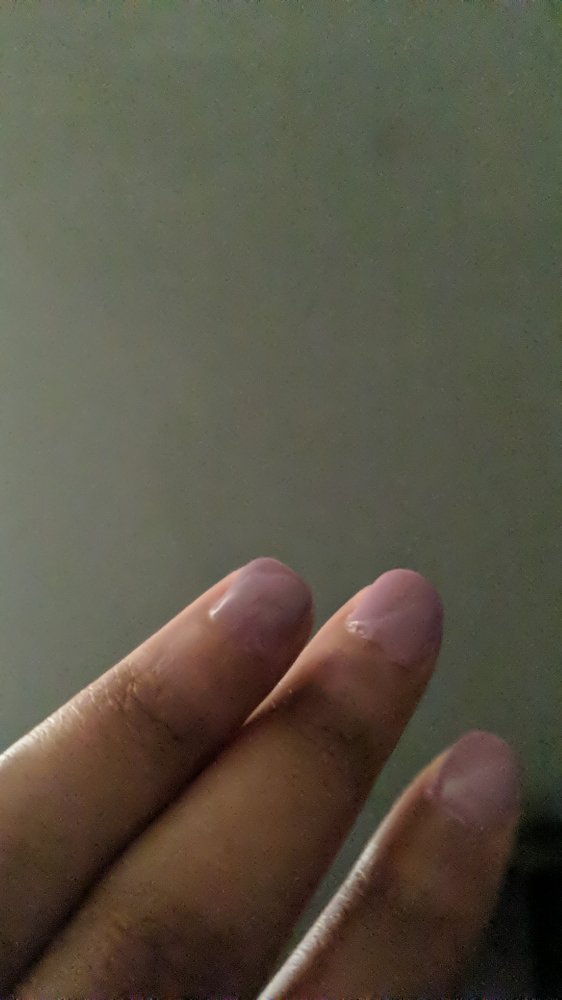 LOTUS NAILS AND SPA 33 Photos & 64 Reviews 1830 Abbey Rd