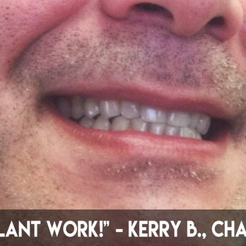 Monroe Family Dentistry - "Can you tell which tooth is the implant? No? That's because it's great work! Thank you Dr. K!" - Kerry B., Charlotte, NC - General Dentistry Near Me - Monroe, North Carolina Monroe Family Dentistry - "Can you tell which tooth is the implant? No? That's because it's great work! Thank you Dr. K!" - Kerry B., Charlotte, NC - General Dentistry Near Me - Monroe, North Carolina
