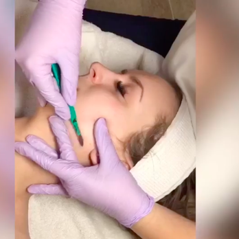 Honey Bee Lash Studio - Dermaplaning- effectively removes dead skin and villus hairs leaving the skin soft and clear - Eyelash Service Near Me - Puyallup, Washington