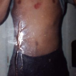 Warren Police Department - Beaten with a maglight flashlight with handcuffs on behind my back...all lives matter..