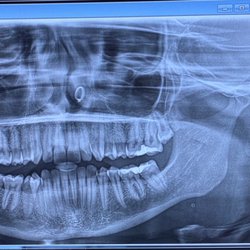 Mammoth Dental - 360 view with their awesome machine