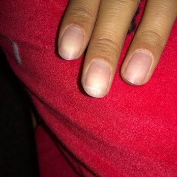 Captivate Nail Spa - crack on my natural nail - Nail Salons Near Me - Fullerton, California