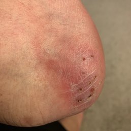 After a week still not healed After a week still not healed