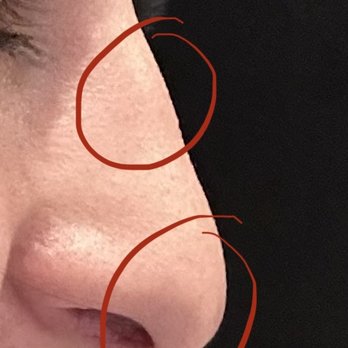 Arash Moradzadeh, MD - Ear Nose & Throat Near Me - Beverly Hills, California